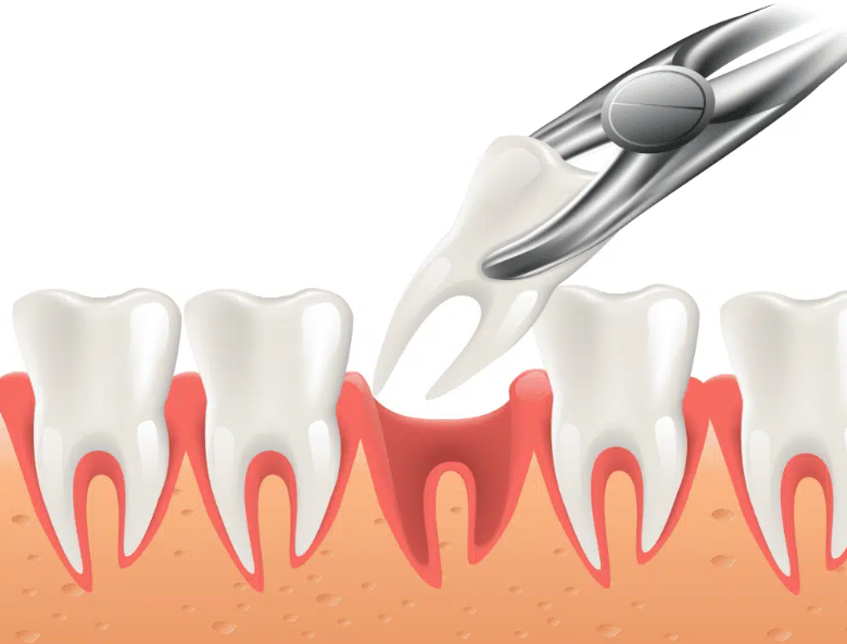 Emergency Care Service